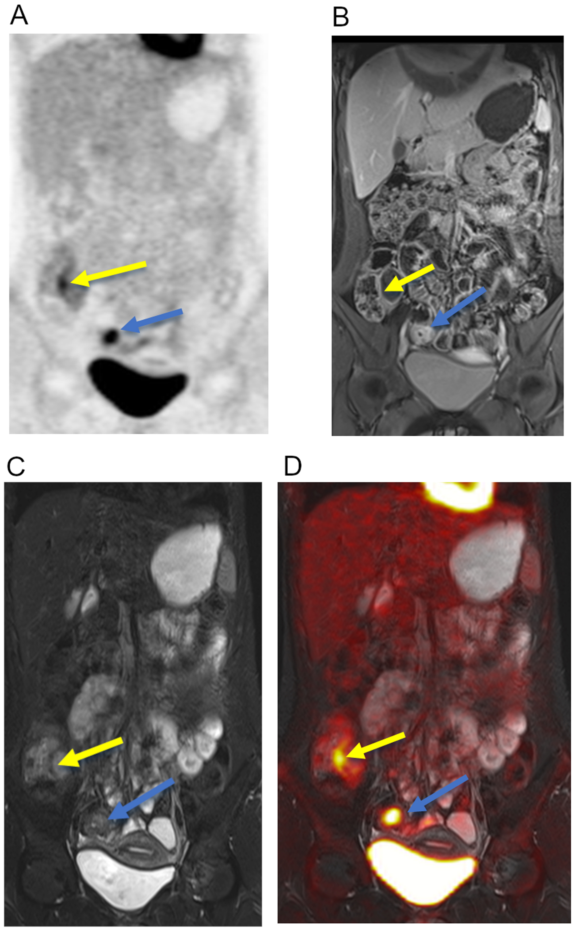 Gastrointestinal Imaging Radiology Key