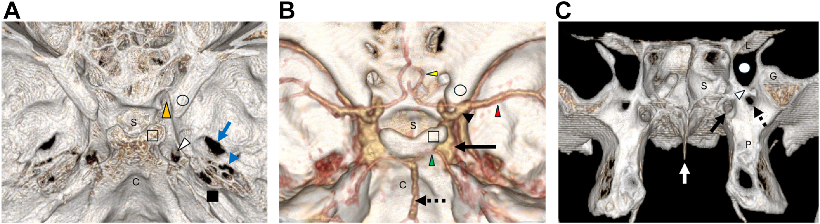 A detailed anatomical in panels labeled A to C with several labeled symbols, arrows, and abbreviations indicating structural regions across the cranial base and surrounding parts.