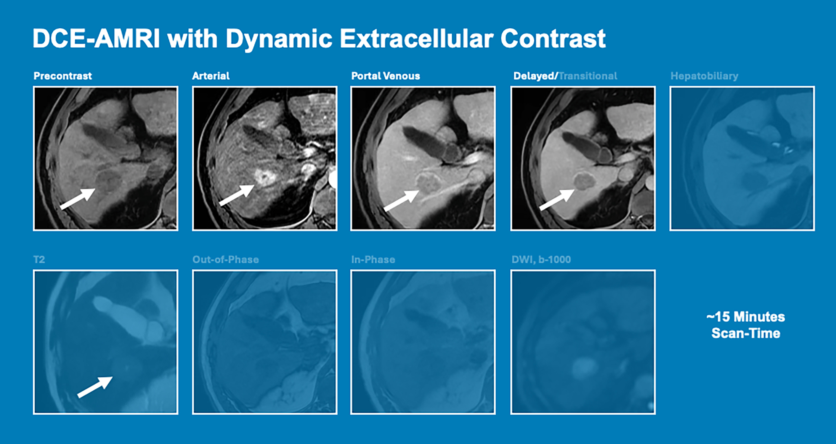 Nine panels show the imaging protocol for a dynamic contrast-enhanced abbreviated M R I (D C E-A M R I), which reduces scan time by focusing on specific contrast phases and essential sequences.