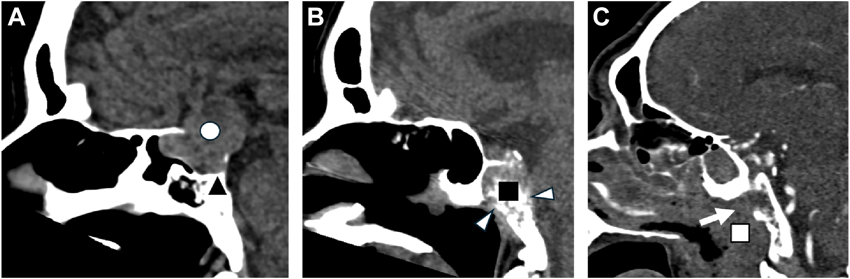 A sagittal scan sequence across panels A to C has various symbols like circles, squares, triangles, and arrows marking different anatomical areas and observations.