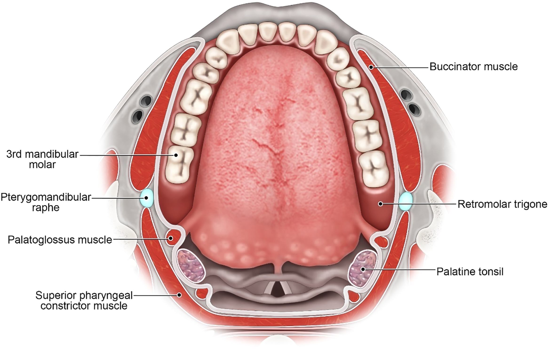 A coronal view of the oral cavity depicts the retromolar trigone, the pterygomandibular raphe, and the surrounding muscles involved in speech and swallowing.