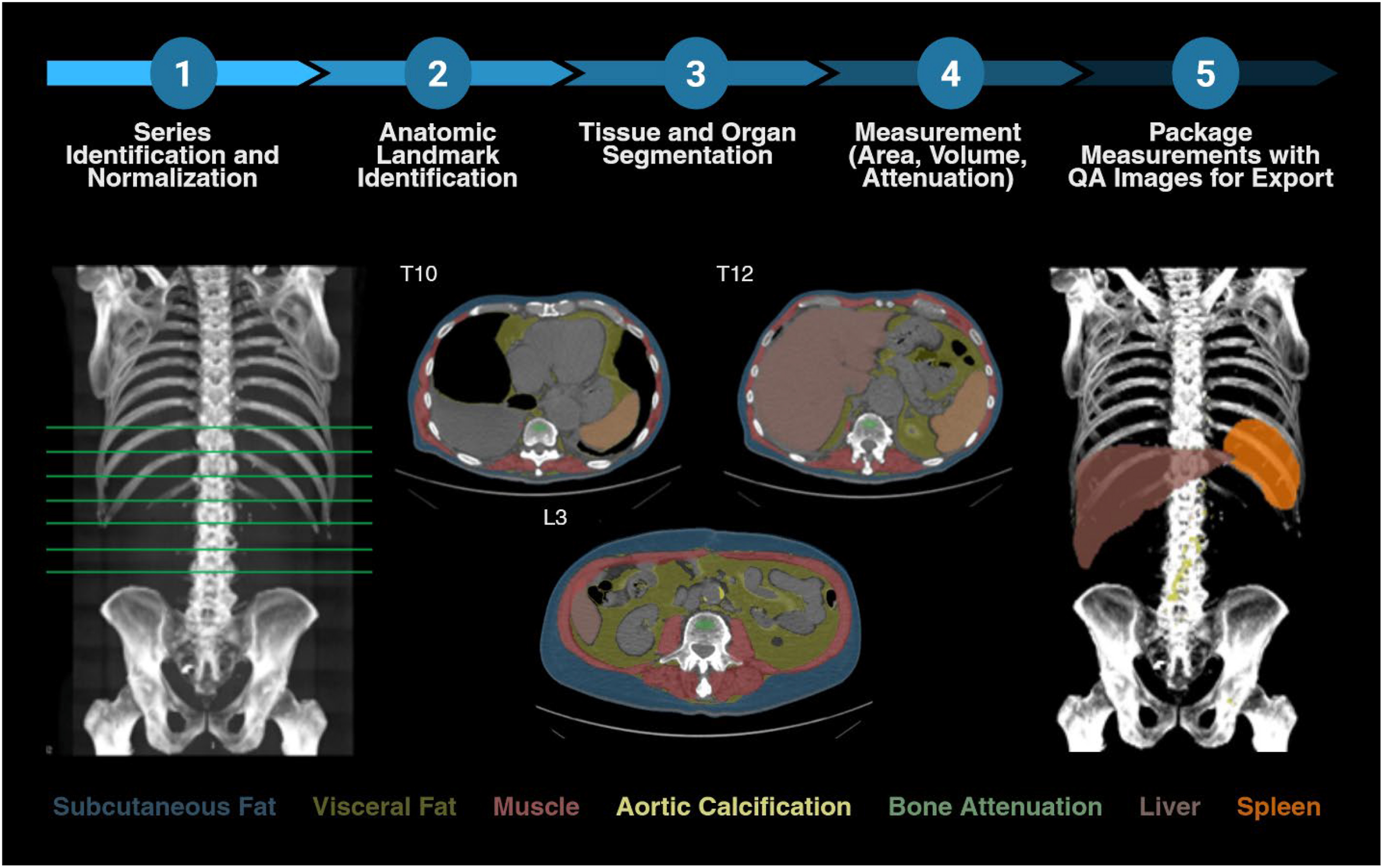 A workflow diagram shows an explainable automated deep learning pipeline that processes chest, abdomen, and pelvis C T scans to extract multiple quantitative imaging biomarkers.