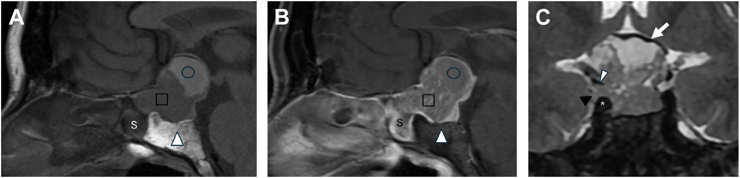 A sagittal and coronal sequence in panels A to C shows shapes and arrows marking regions, including circle, square, triangle, arrowhead, and star along labeled S and C areas.