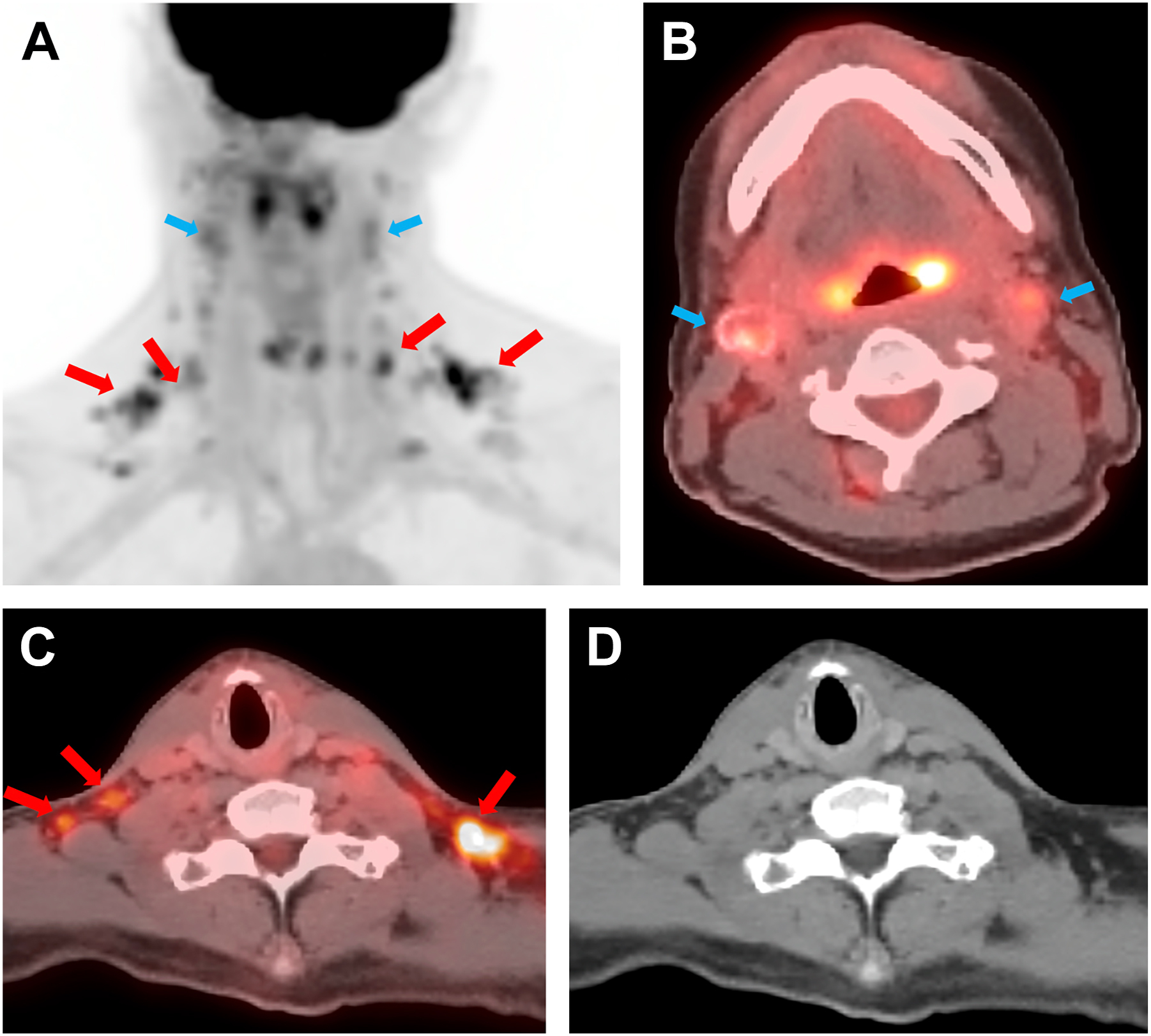 Four axial positron emission tomography scans labeled A to D, highlighting anatomical regions with arrows and circular markers.