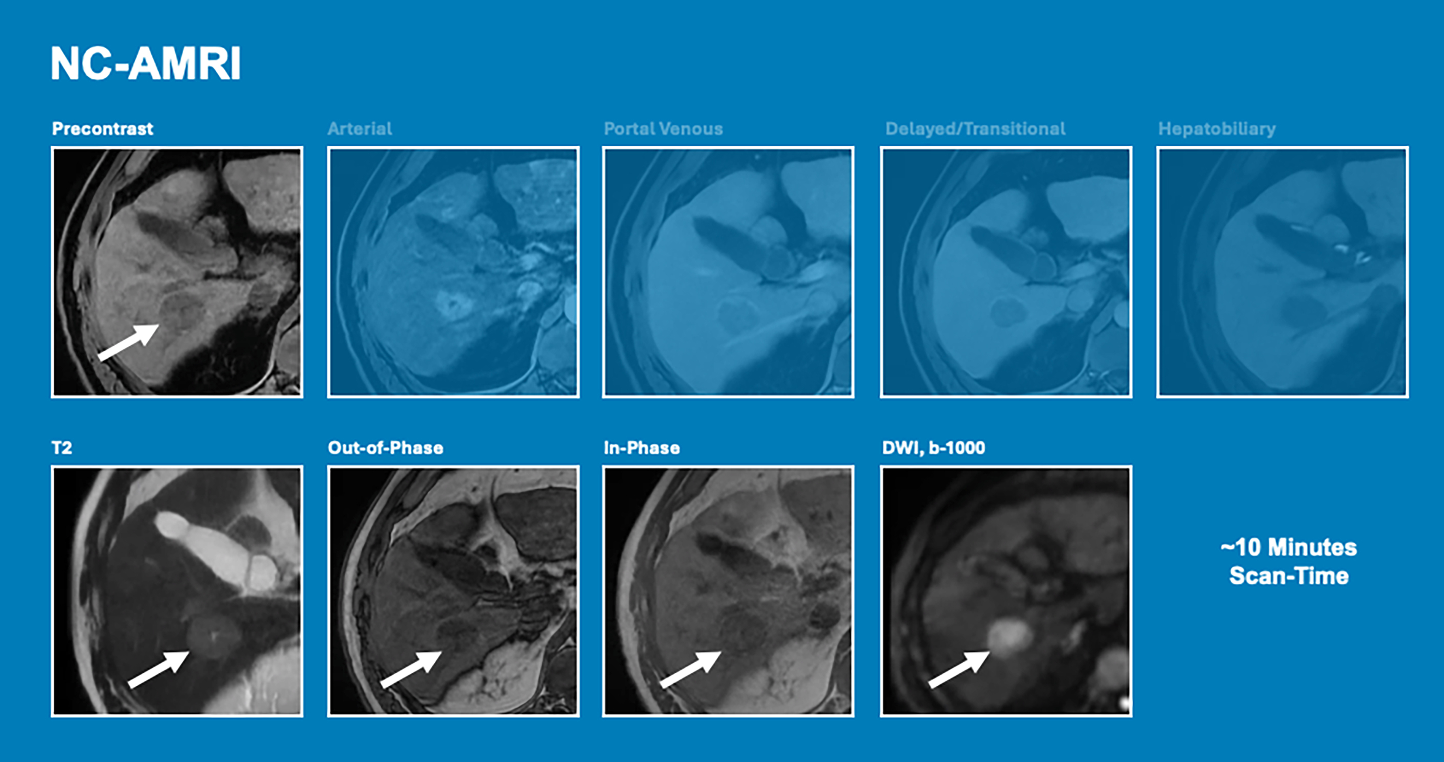 Nine panels show a non-contrast abbreviated M R I liver protocol using selected sequences to evaluate hepatic lesions without contrast in a short scan time.