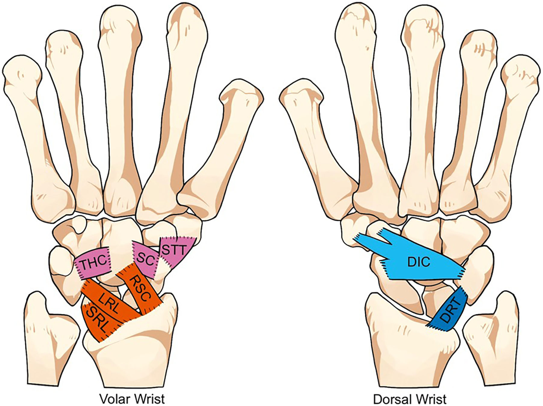 A medical illustration shows the secondary stabilizers of the human wrist.