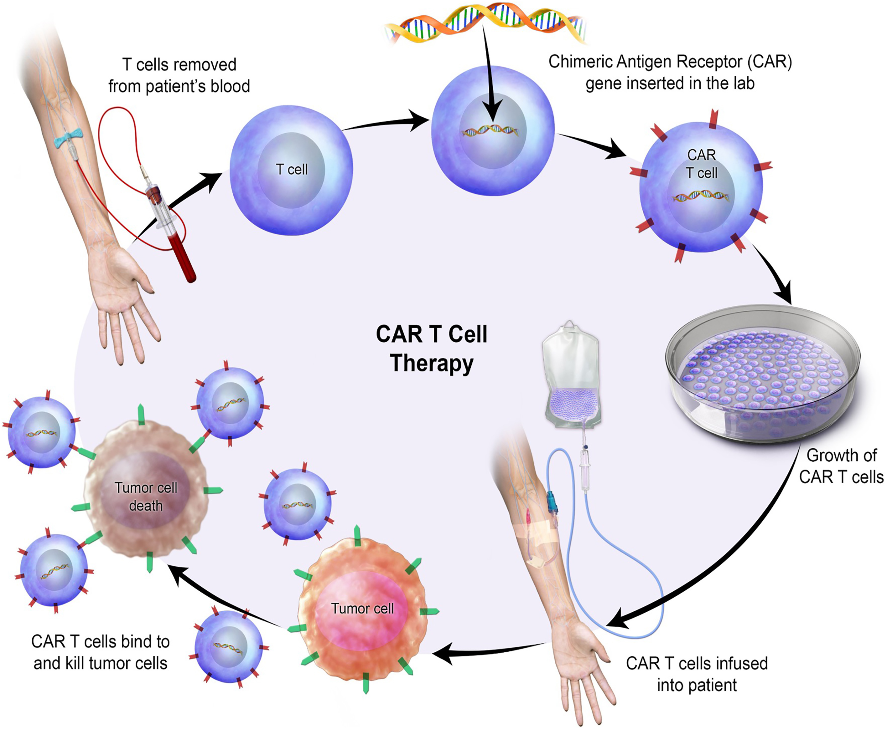 A biomedical schematic diagram illustrates the complete cycle of chimeric antigen receptor T cell therapy from extraction to tumor cell lysis.