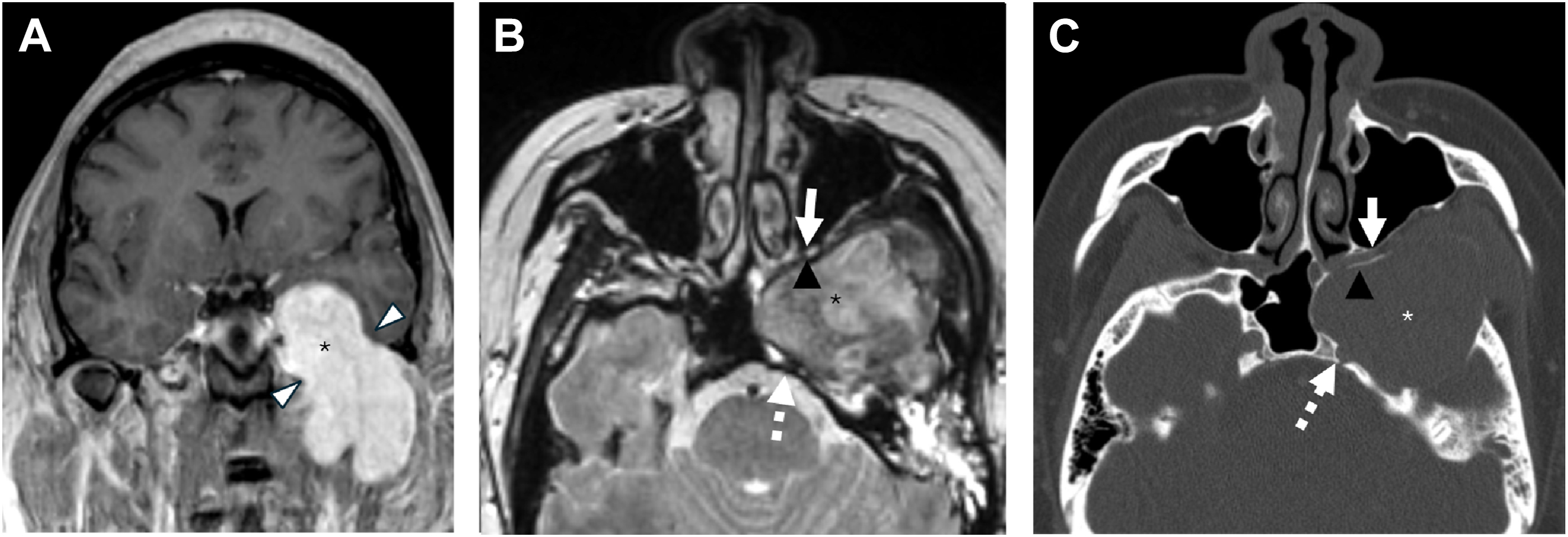 A coronal and axial scan shows panels A, B, and C with stars, arrowheads, arrows, and dotted arrows marking distinct structures in different positions of the head.