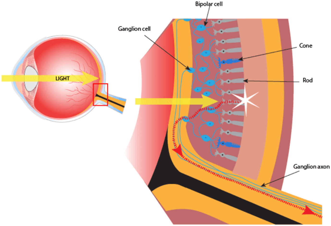 A diagram shows light entering the eye and hitting retinal photoreceptors, which pass signals through bipolar and ganglion cells to form the optic nerve traveling to the brain.