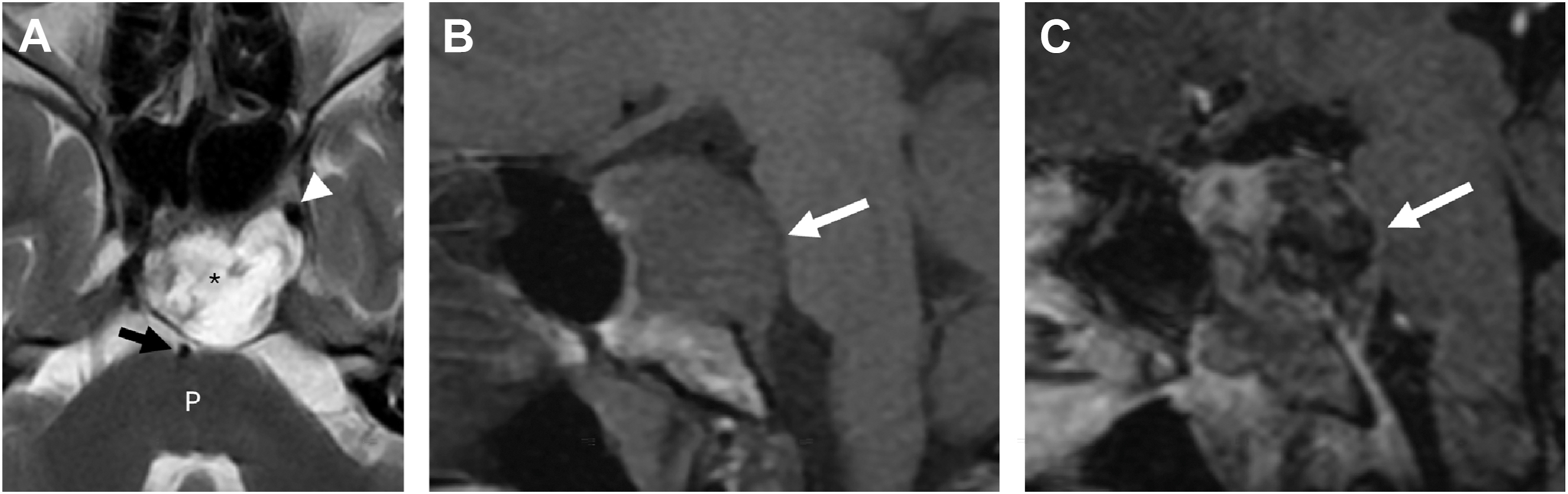 A set of three head scans shows arrows, a star, and an arrowhead marking different regions, including labeled structure P in the lower part of the first scan.