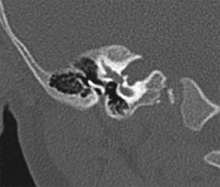 The External Auditory Canal and Pinna | Radiology Key