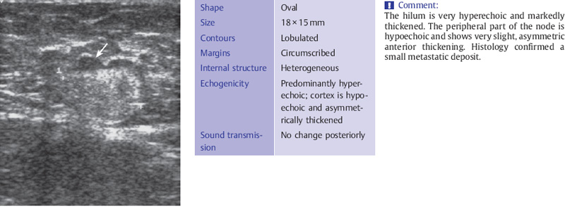 Lymph Nodes Radiology Key