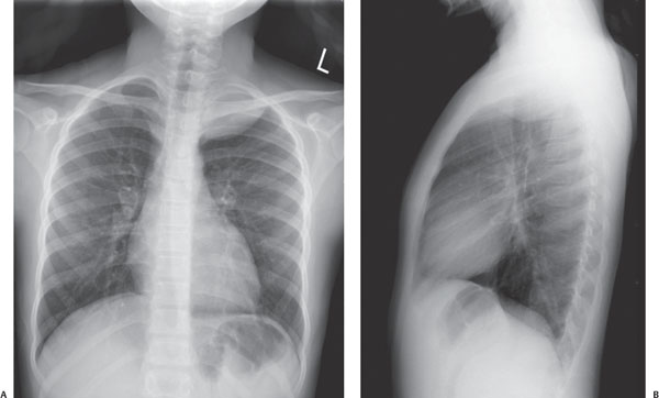 6 | Radiology Key