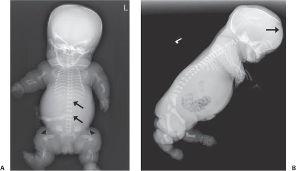 81 | Radiology Key