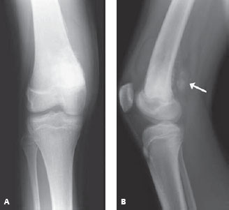 84 | Radiology Key