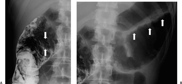 24 | Radiology Key