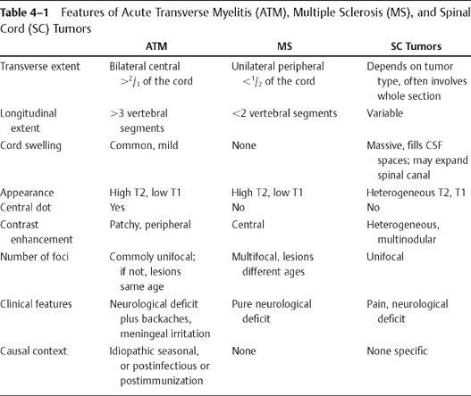 4 Transverse Myelitis | Radiology Key