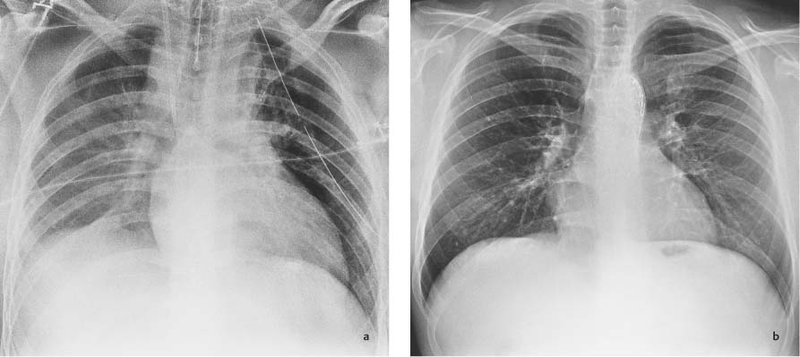 Conventional Radiography | Radiology Key