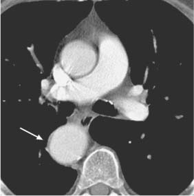 Computed Tomography Radiology Key