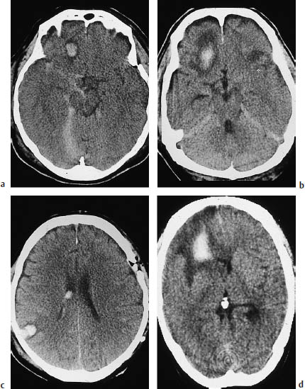 Fig.2.3