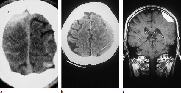 Fig.2.6