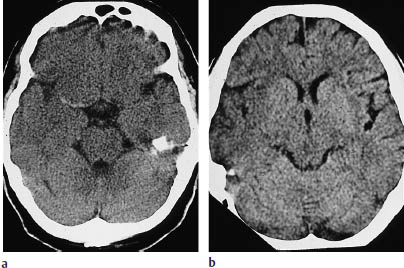 Fig.3.2