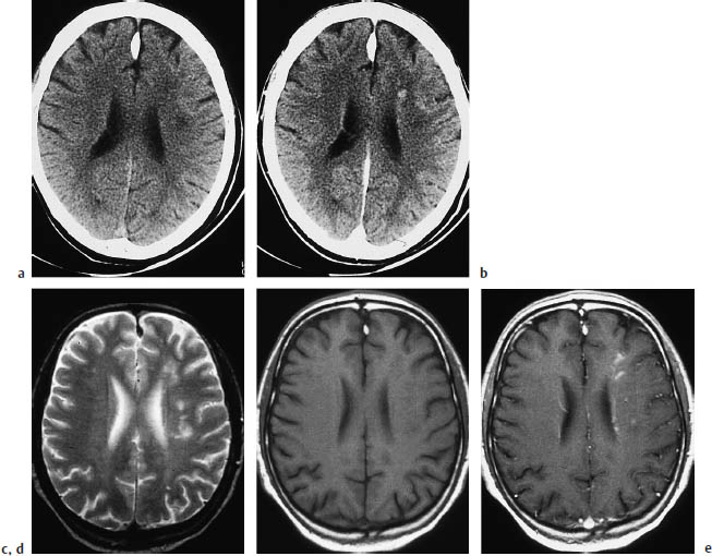 Fig.3.7