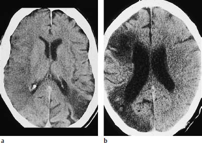 Fig.3.8