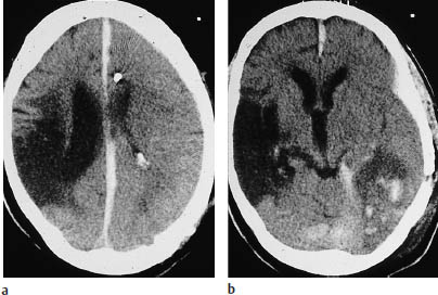 Fig.3.14