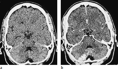 Fig.3.16