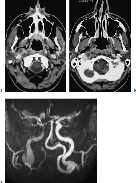 Fig.3.19