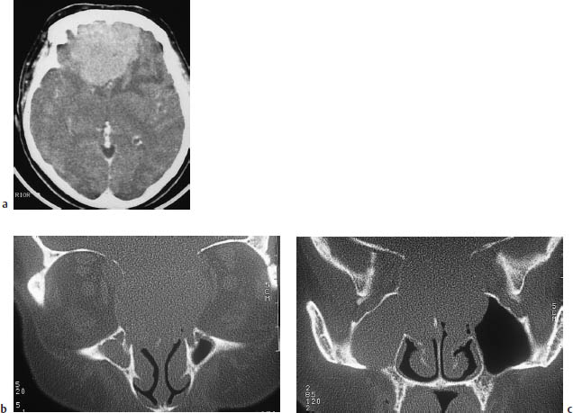 Fig.5.26