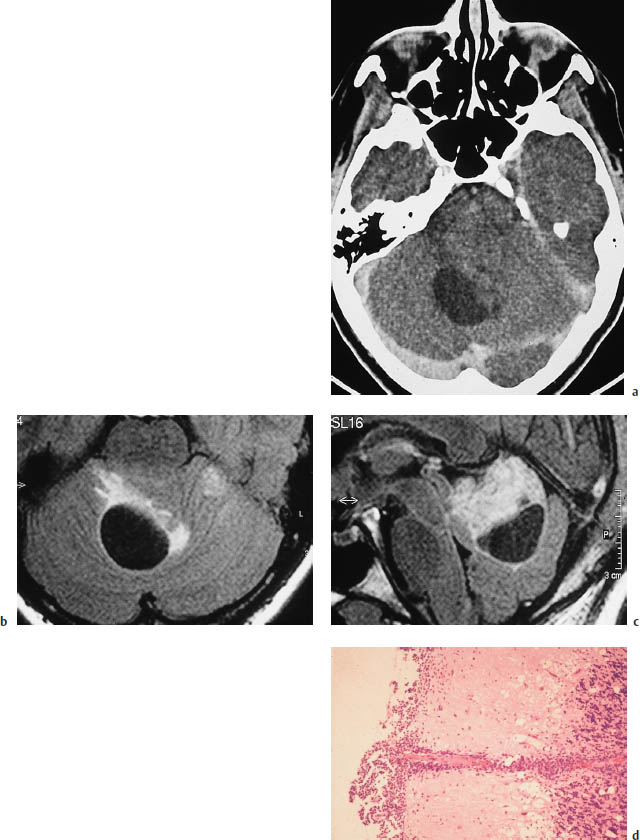 Fig.5.28