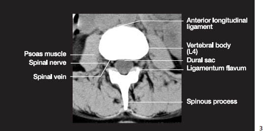 Fig.1c.