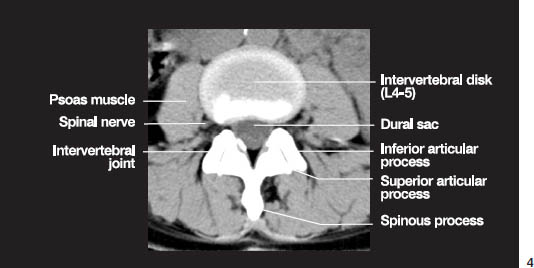 Fig.1d.