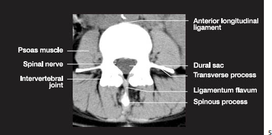 Fig.1e.