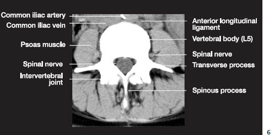 Fig.1f.