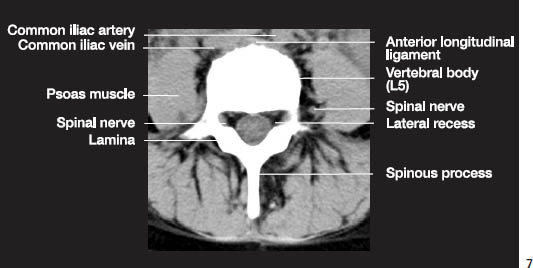 Fig.1g.