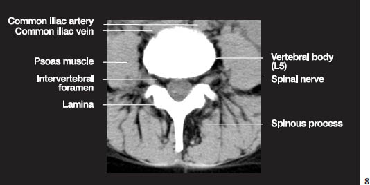 Fig.1h.