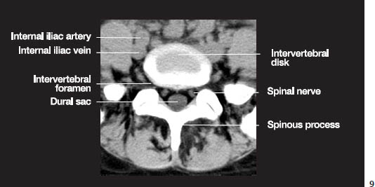 Fig.1i.