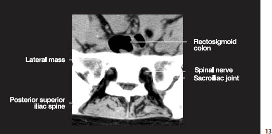 Fig.1m.