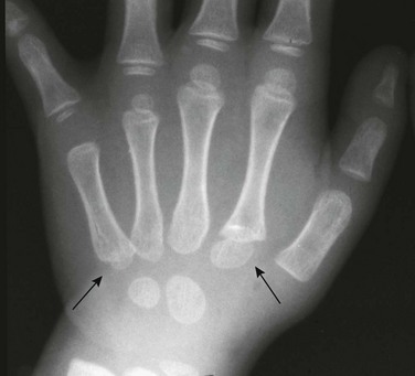 Embryology, Anatomy, and Normal Findings | Radiology Key