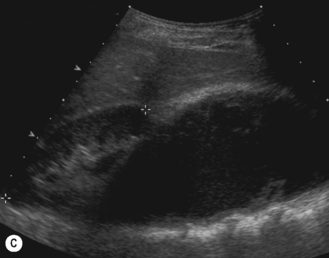 The abdomen and bowel | Radiology Key