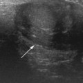 variable presentation ultrasound