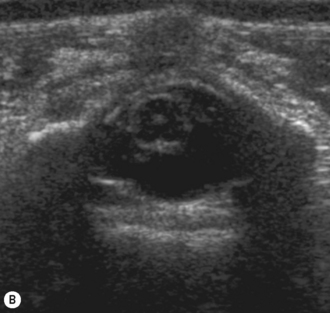 The head, neck and spine | Radiology Key