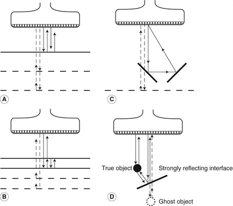 Optimizing the scan | Radiology Key