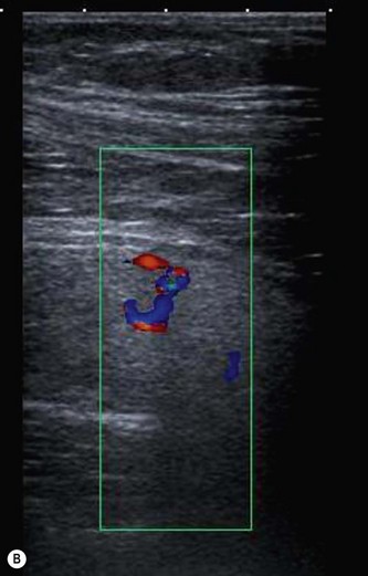 The Pancreas | Radiology Key