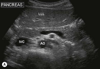 pancreas ultrasound