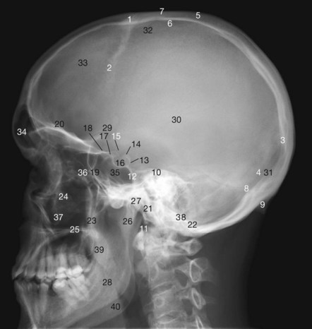 Head and neck | Radiology Key