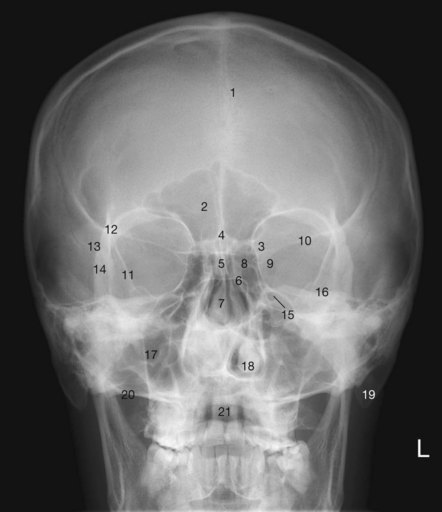 Head and neck | Radiology Key